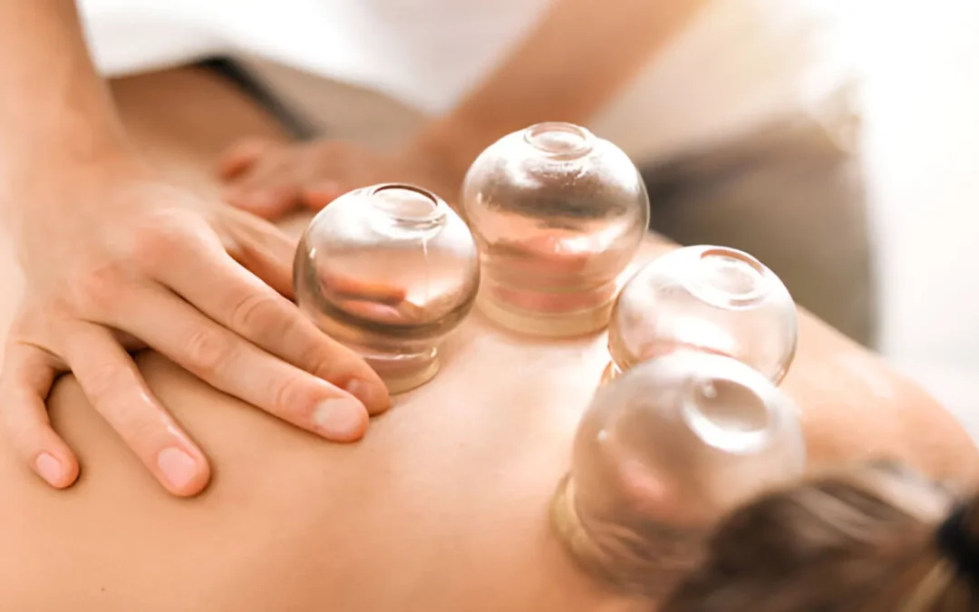Benefits of Cupping Therapy: A Comprehensive Guide