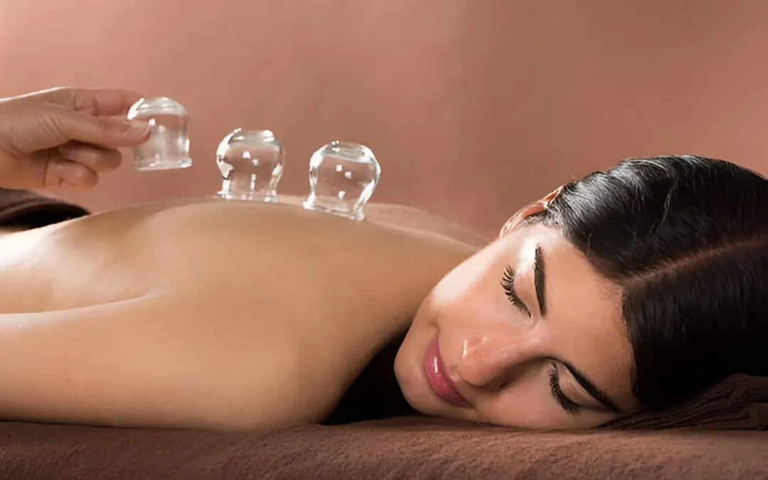 Cupping Therapy Benefits: Discover the Healing Power at Relax Day Spa