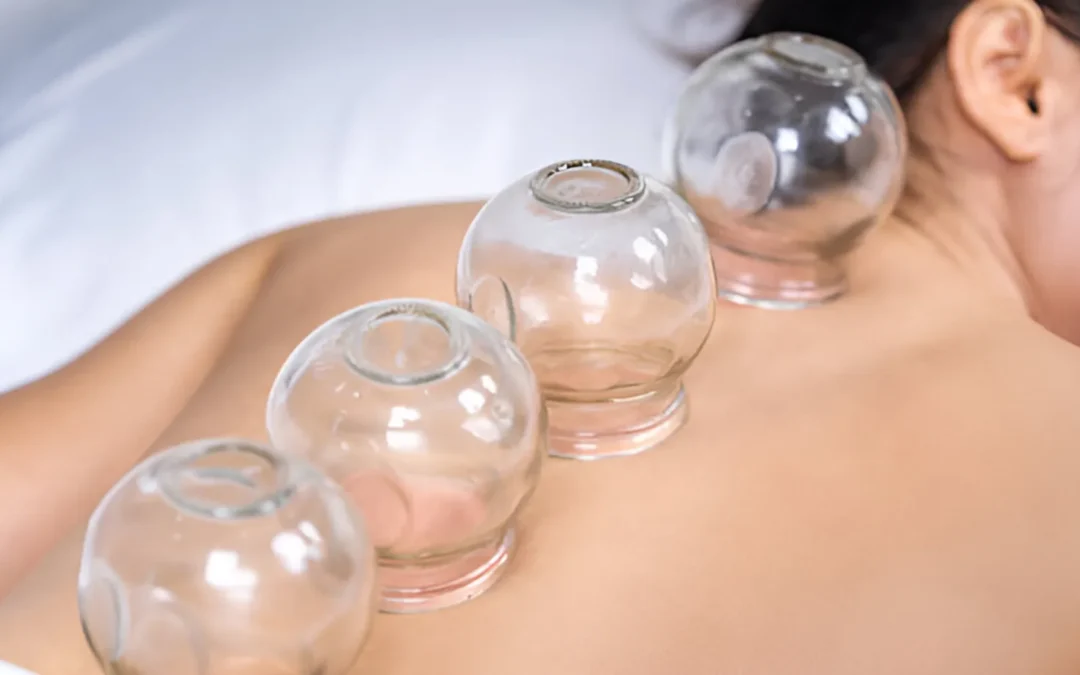 What Does Cupping Therapy Do? Discover the Benefits at Relax Day Spa