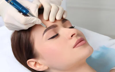Affordable Skin Needling Treatment Melbourne City