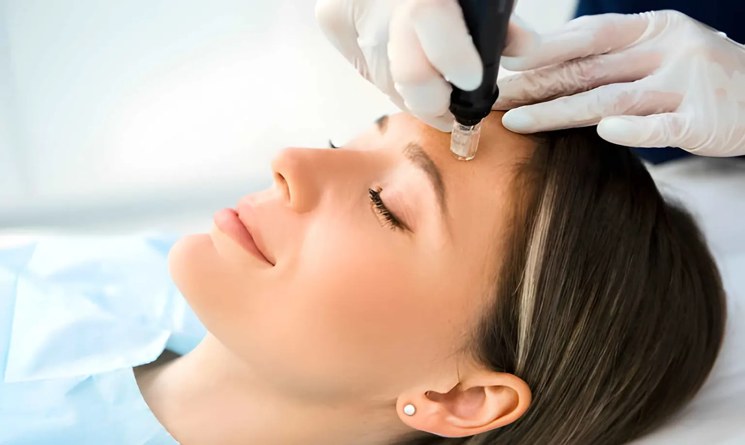 Skin needling treatment Melbourne near me