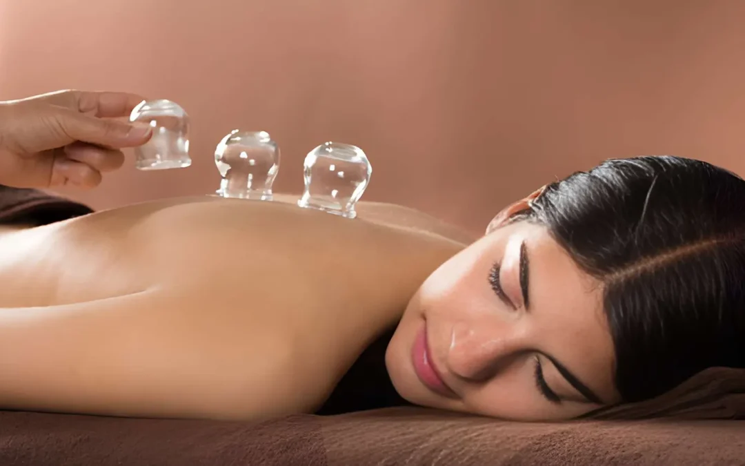 Affordable Cupping Therapy in Melbourne