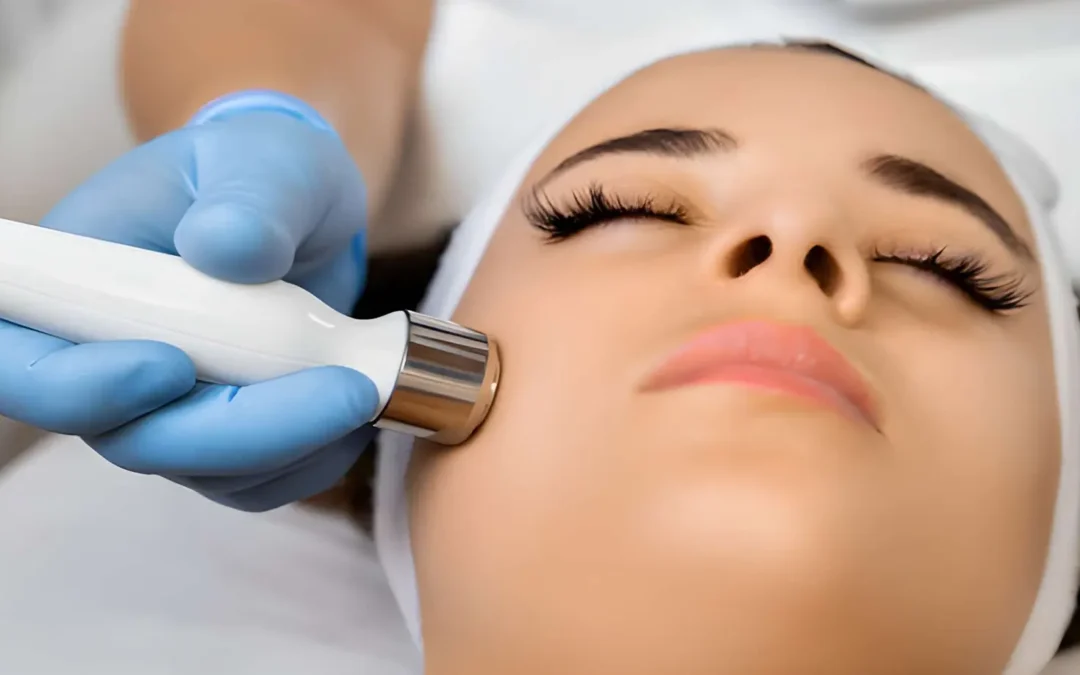 Skin Needling Treatment Near Melbourne CBD