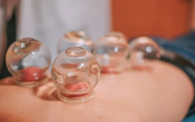 Affordable Cupping Therapy Services Melbourne