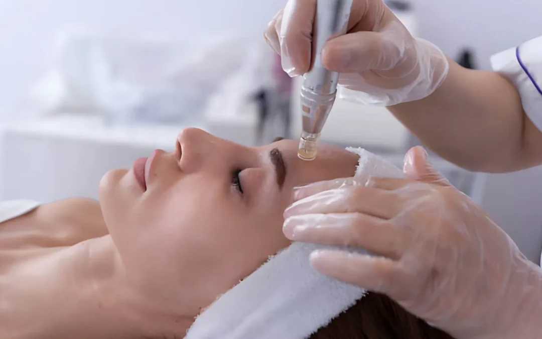Best Skin Needling Treatment in Melbourne City