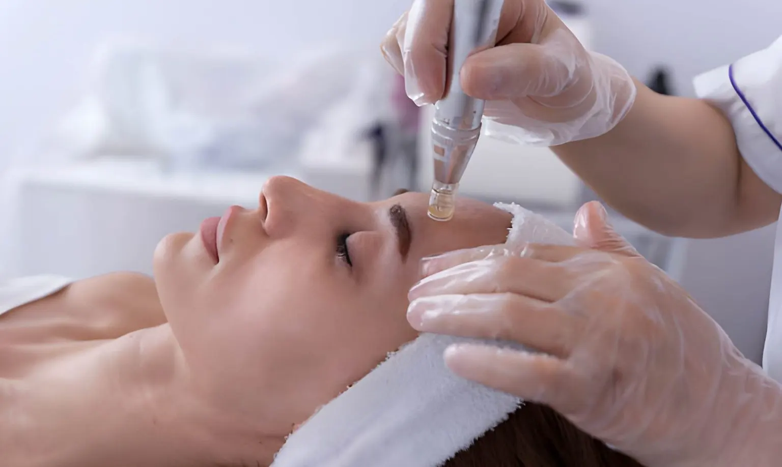 Best Skin Needling Treatment in Melbourne City