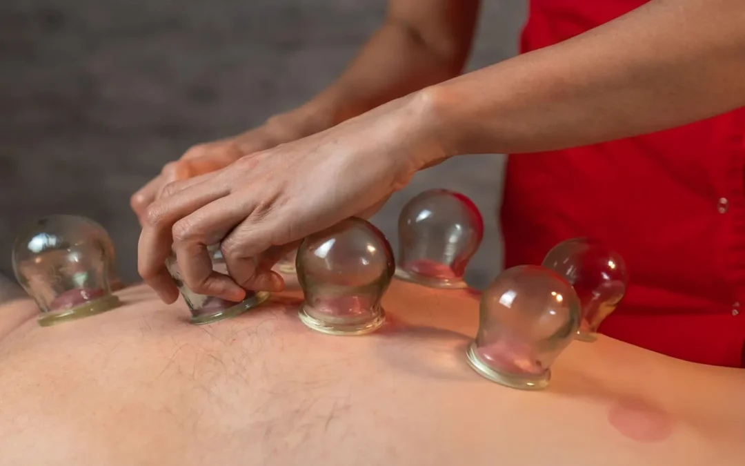 Relaxing Cupping Therapy Melbourne CBD