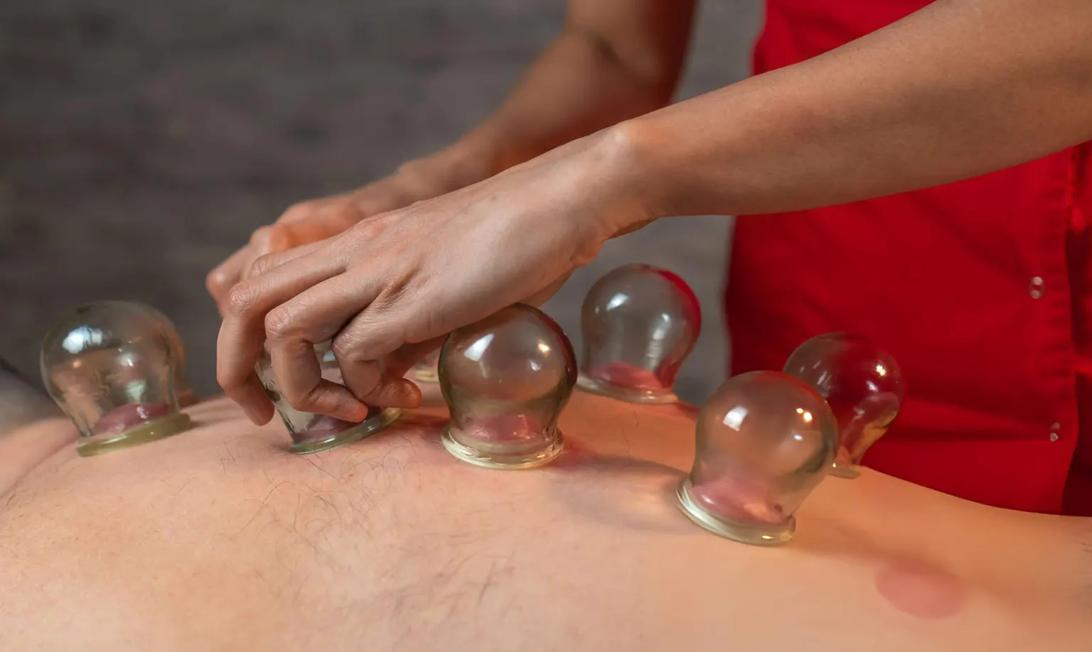 Relaxing Cupping Therapy Melbourne CBD