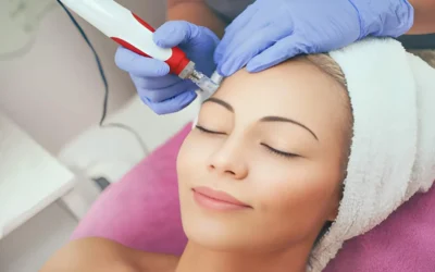 Skin Needling Treatment Melbourne Special Offers