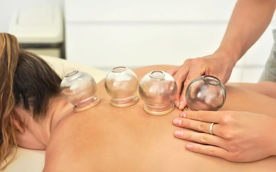 Discover Affordable Cupping Therapy Melbourne