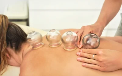 Discover Affordable Cupping Therapy Melbourne