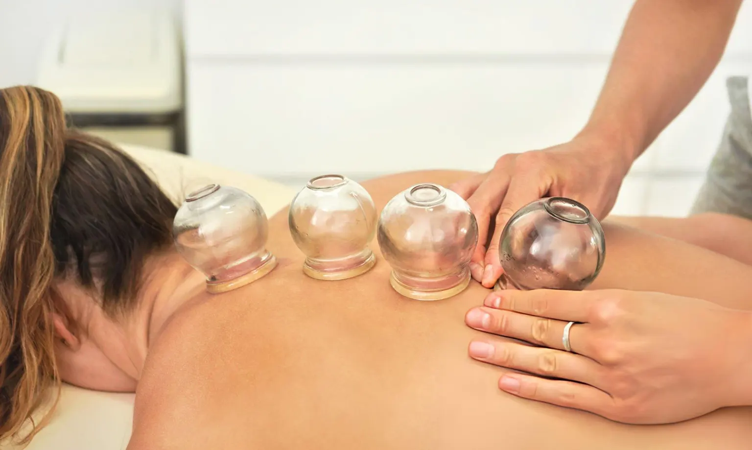 Discover Affordable Cupping Therapy Melbourne