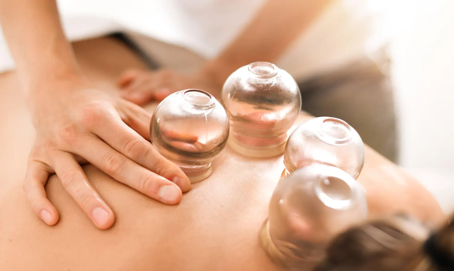 Traditional Cupping Therapy Melbourne Services